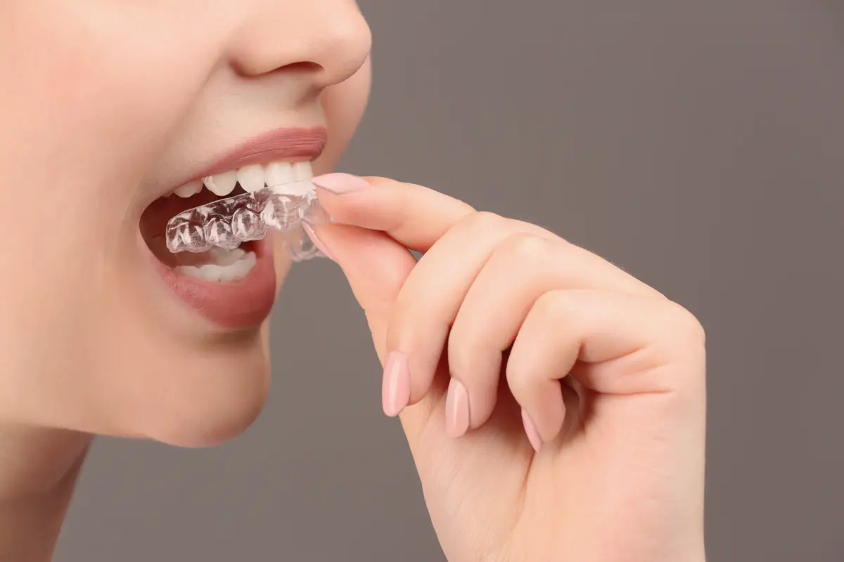 invisalign