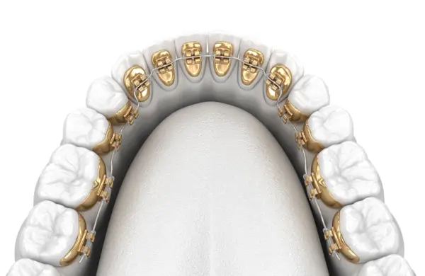 https://jeiroudibraces.ae/wp-content/uploads/2024/10/lingual_main_600.webp