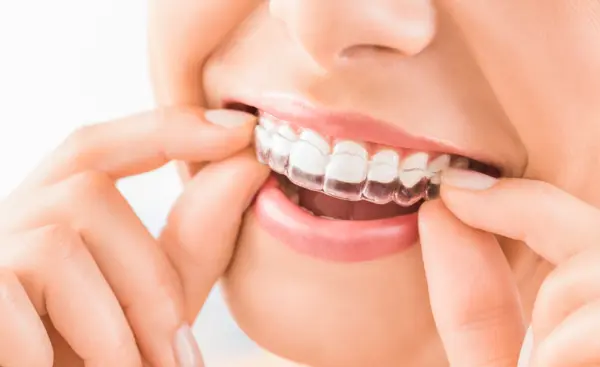 https://jeiroudibraces.ae/wp-content/uploads/2024/10/retainer_removeable_600.webp